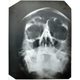 Illustration for article titled This is Hitlers skull